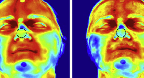 Sensing Bio-Metrics from Anywhere on the Body